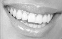 Implantate Implantate